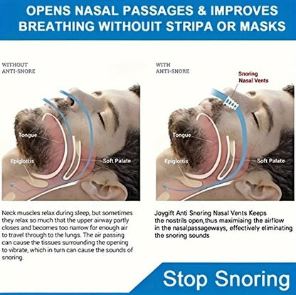 10x Anti Snore Nose Clip Stop Snoring Stopper Device Sleep Aids Cones Vent